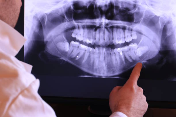 Best Emergency Treatment for Toothache in Emerald Isle, NC
